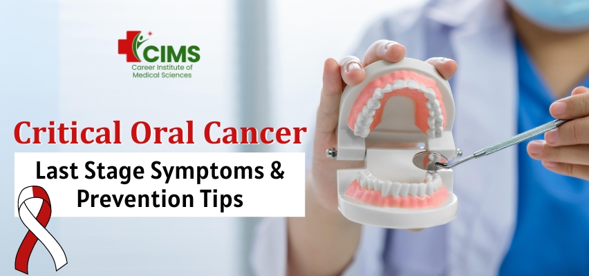 Critical Oral Cancer Last Stage Symptoms & Prevention Tips