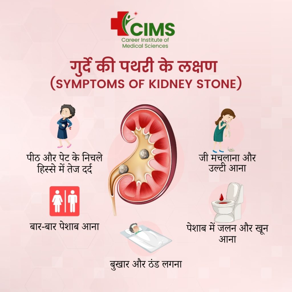 kidney stone symptoms in hindi