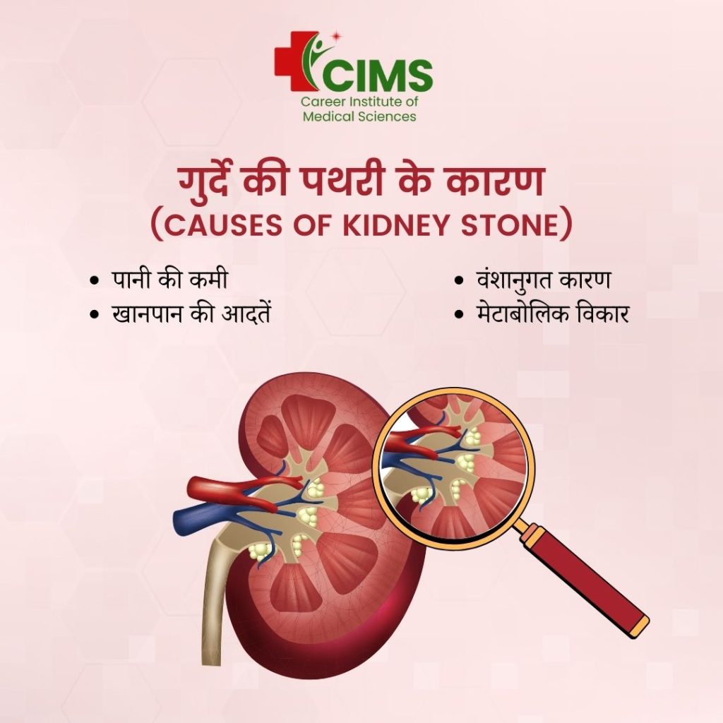 Kidney Stone Symptoms in Hindi