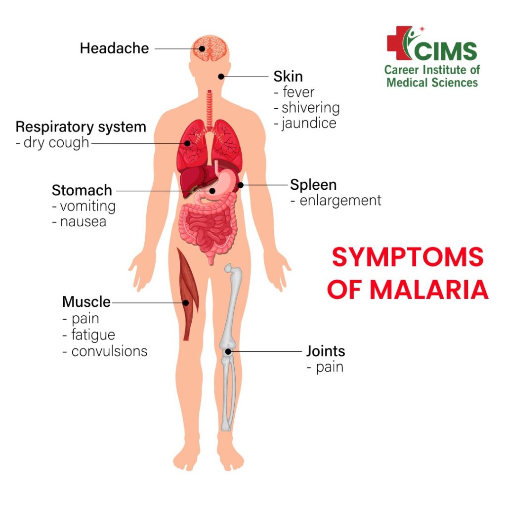 Symptoms of Malaria