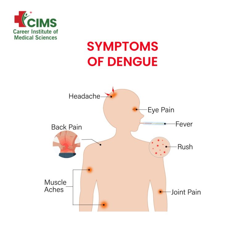 Symptoms of Dengue