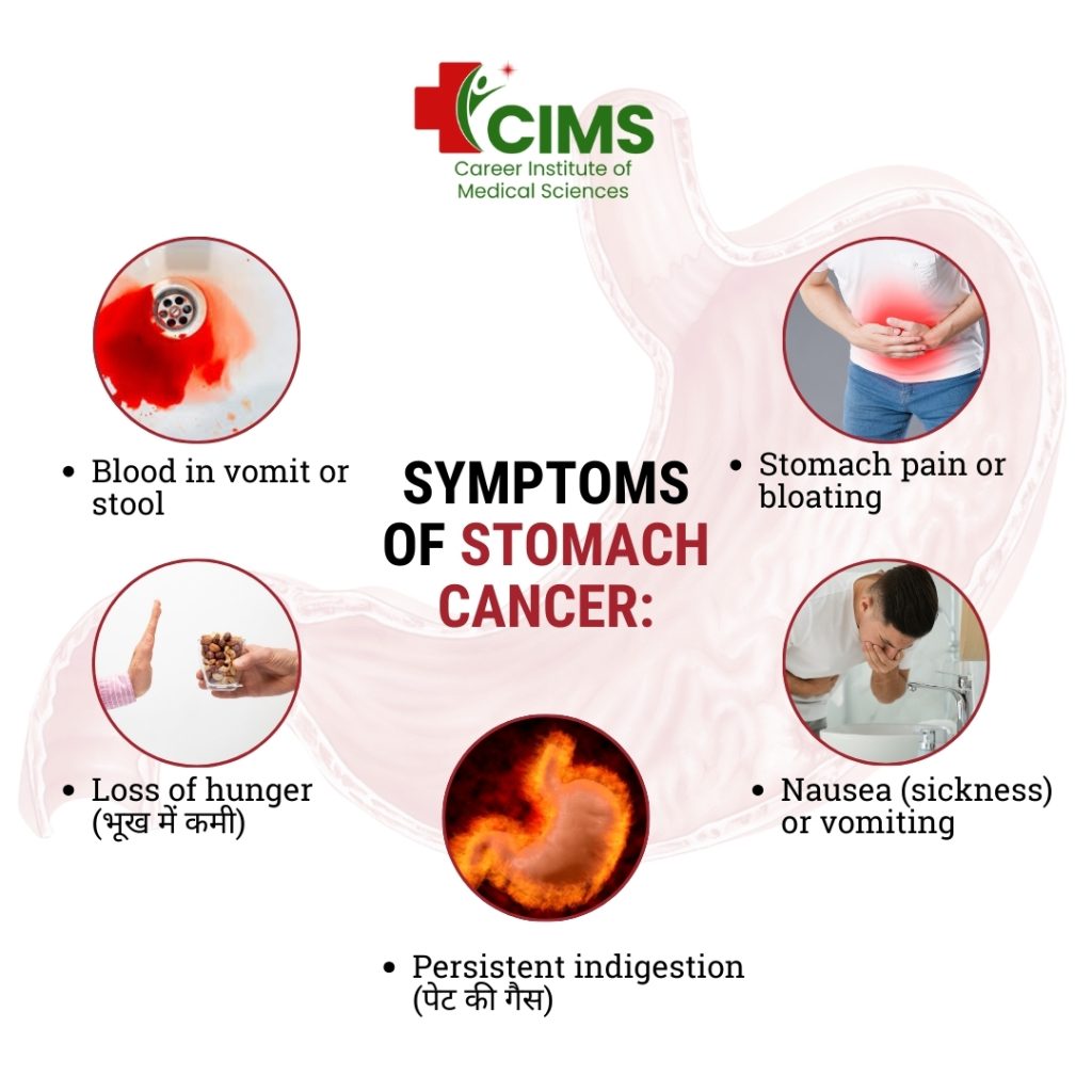 Most Common Cancer in Male in India