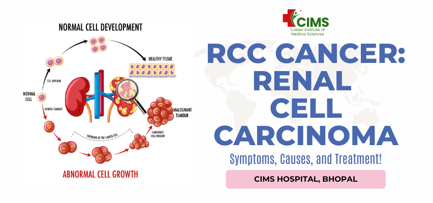 RCC Cancer: Renal Cell Carcinoma Symptoms, Causes, and Treatment