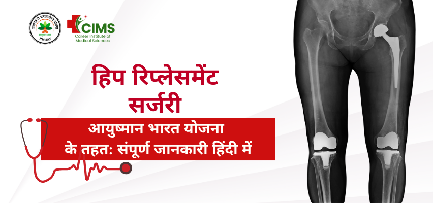 Total Hip Replacement Surgery In Ayushman Card– सम्पूर्ण जानकारी हिंदी में