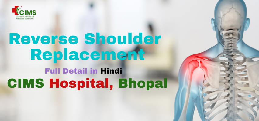 Reverse Shoulder Replacement