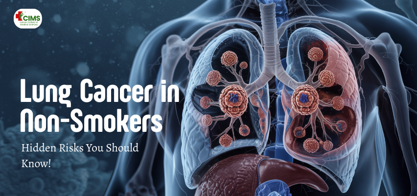 Lung Cancer in Non-Smokers: Hidden Risks You Should Know