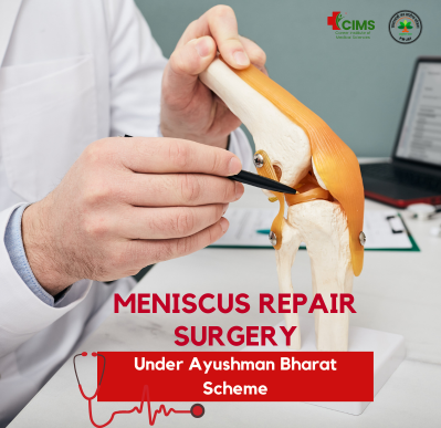 Meniscus Repair Surgery Cost