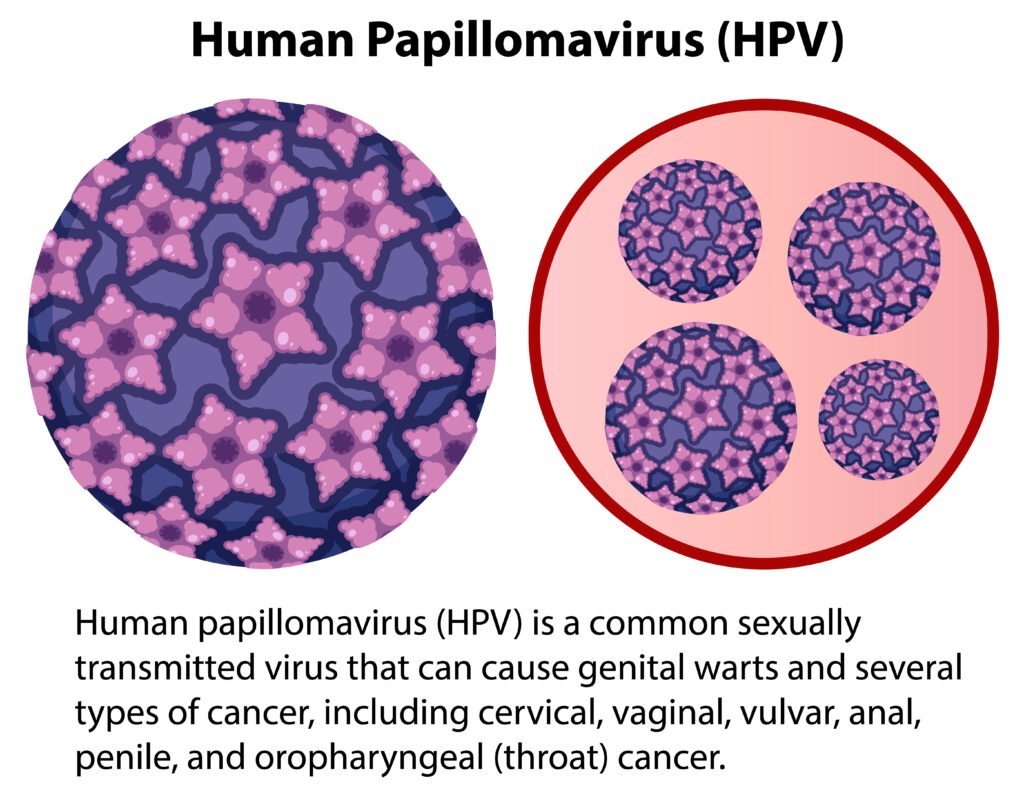 What Is HPV? Human Papillomavirus (HPV) – Causes, Symptoms, Vaccine & Prevention