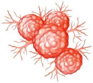 What is the Difference Between Tumor and Cancer