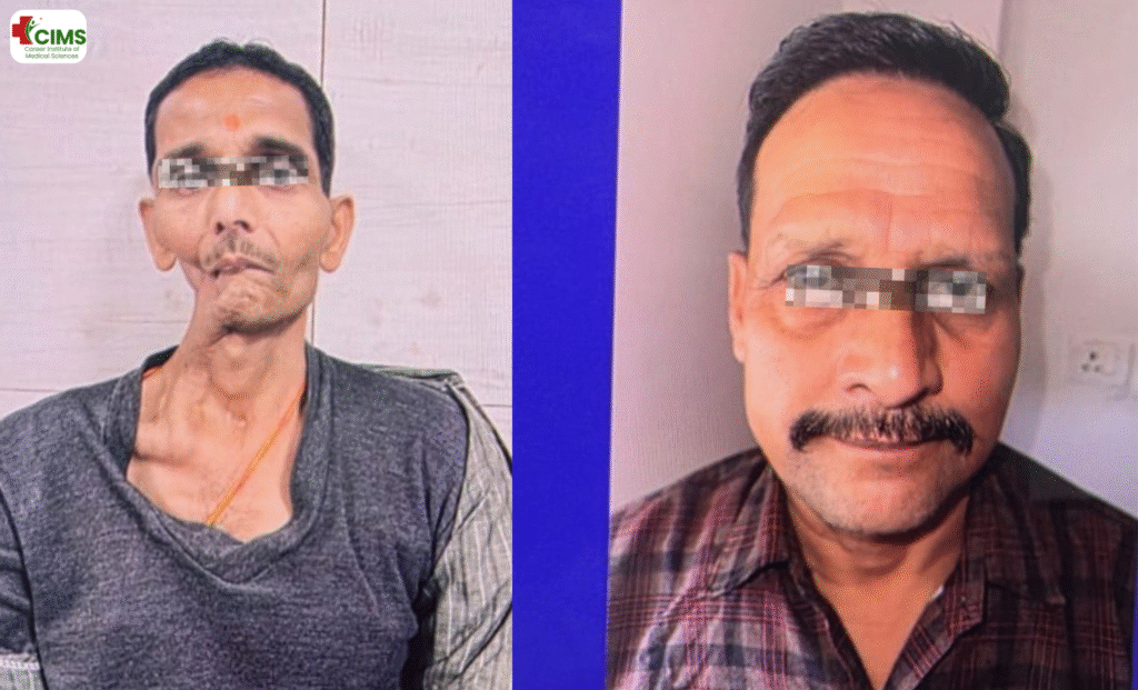 सिर और गर्दन के कैंसरसिर और गर्दन के कैंसर Head and Neck Oncology in Bhopal