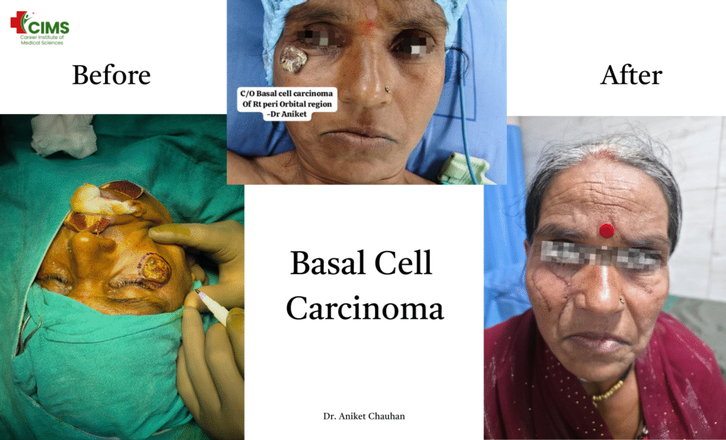 सिर और गर्दन के कैंसरसिर और गर्दन के कैंसर Head and Neck Oncology in Bhopal