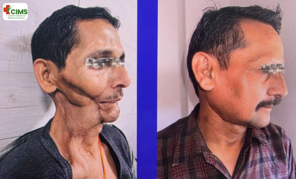 सिर और गर्दन के कैंसरसिर और गर्दन के कैंसर Head and Neck Oncology in Bhopal