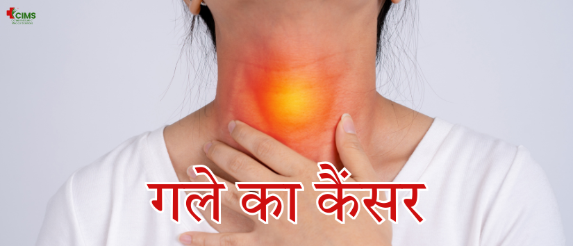 गले का कैंसर की पहचान