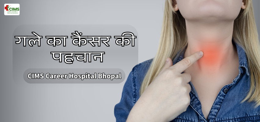 गले का कैंसर की पहचान