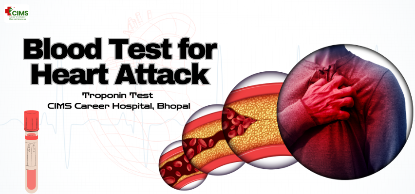 Blood Test for Heart Attack | Troponin Test