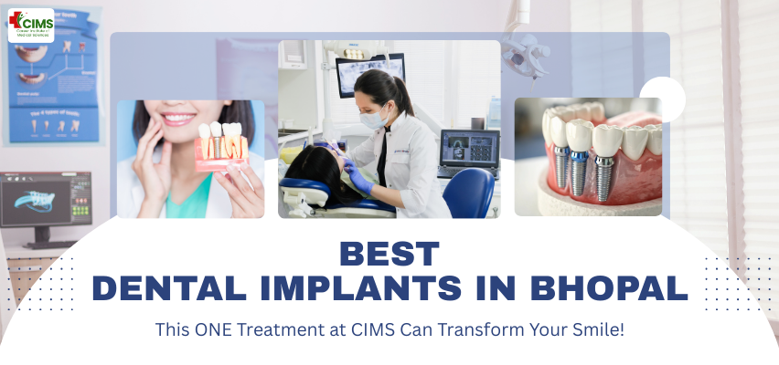 Dental Implants in Bhopal